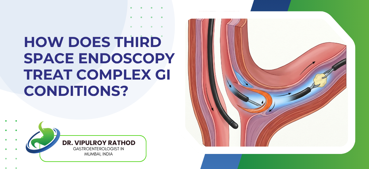 How Does Third Space Endoscopy Treat Complex GI Conditions