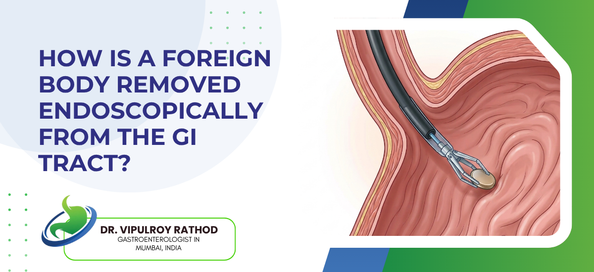 How Is a Foreign Body Removed Endoscopically From the GI Tract