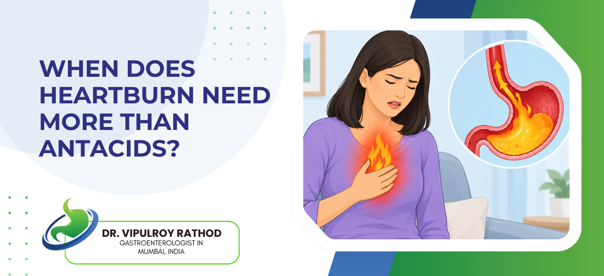 Banner illustrating heartburn: a woman clutching her chest with a highlighted flame and a circular inset of a stomach showing acid, about when to pursue care beyond antacids.